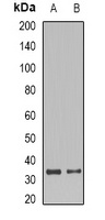 SET Rabbit Polyclonal Antibody