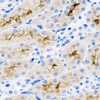 SET Rabbit Polyclonal Antibody