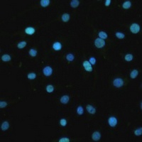 SET Rabbit Polyclonal Antibody
