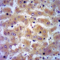SerpinB1 Rabbit Polyclonal Antibody