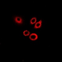 SerpinB1 Rabbit Polyclonal Antibody