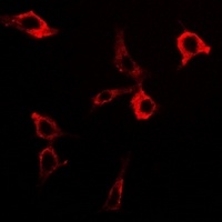 PDC-E2 Rabbit Polyclonal Antibody