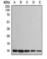 UBE2B Rabbit Polyclonal Antibody
