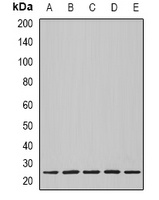 Nop30 Rabbit Polyclonal Antibody
