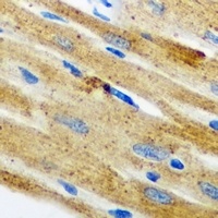 Nop30 Rabbit Polyclonal Antibody
