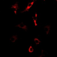Nop30 Rabbit Polyclonal Antibody