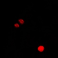 CLIC1 Rabbit Polyclonal Antibody