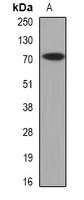 CAT1 Rabbit Polyclonal Antibody