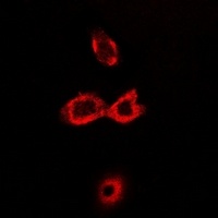 CAT1 Rabbit Polyclonal Antibody
