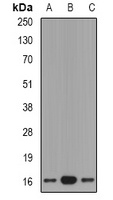 GRP Rabbit Polyclonal Antibody