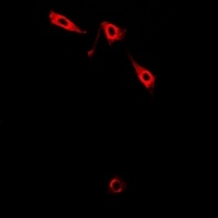 Pinch-1 Rabbit Polyclonal Antibody