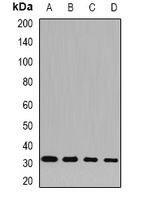 SNRPA Rabbit Polyclonal Antibody
