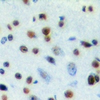 SNRPA Rabbit Polyclonal Antibody
