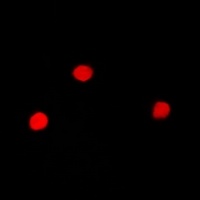 SNRPA Rabbit Polyclonal Antibody