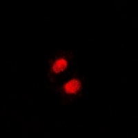 SSRP1 Rabbit Polyclonal Antibody