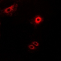 Secretogranin-2 Rabbit Polyclonal Antibody