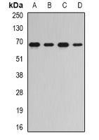 RNGTT Rabbit Polyclonal Antibody