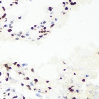 RNGTT Rabbit Polyclonal Antibody