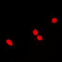 RNGTT Rabbit Polyclonal Antibody