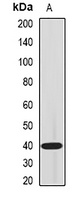 IL-18BP Rabbit Polyclonal Antibody