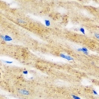 IL-18BP Rabbit Polyclonal Antibody