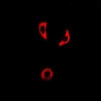 IL-18BP Rabbit Polyclonal Antibody