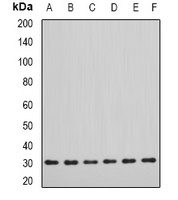 DDAH2 Rabbit Polyclonal Antibody