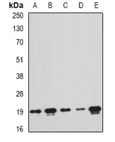 PTRH2 Rabbit Polyclonal Antibody