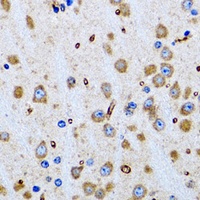 PTRH2 Rabbit Polyclonal Antibody