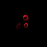PTRH2 Rabbit Polyclonal Antibody