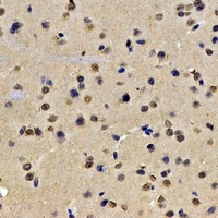 Lamin B2 Rabbit Polyclonal Antibody