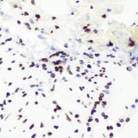 SHARP-2 Rabbit Polyclonal Antibody