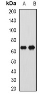 CTNNBL1 Rabbit Polyclonal Antibody