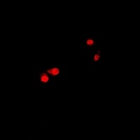 CTNNBL1 Rabbit Polyclonal Antibody