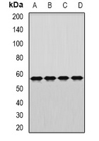 DARS Rabbit Polyclonal Antibody