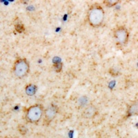 DARS Rabbit Polyclonal Antibody