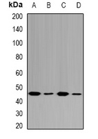 Fumarylacetoacetase Rabbit Polyclonal Antibody