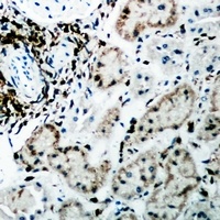 Fumarylacetoacetase Rabbit Polyclonal Antibody