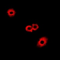Fumarylacetoacetase Rabbit Polyclonal Antibody