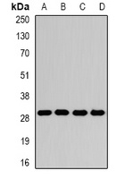 GAMT Rabbit Polyclonal Antibody