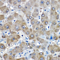 GAMT Rabbit Polyclonal Antibody