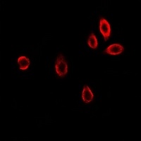 GAMT Rabbit Polyclonal Antibody