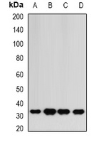 HAGH Rabbit Polyclonal Antibody