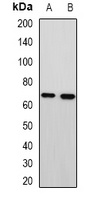 MTA3 Rabbit Polyclonal Antibody