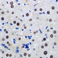 MTA3 Rabbit Polyclonal Antibody