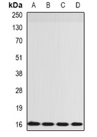 RPS14 Rabbit Polyclonal Antibody