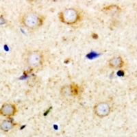 RPS14 Rabbit Polyclonal Antibody