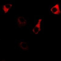 RPS14 Rabbit Polyclonal Antibody