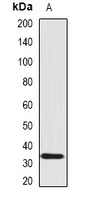 SCO1 Rabbit Polyclonal Antibody