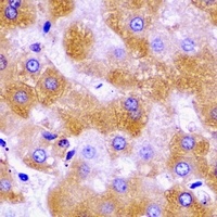 SCO1 Rabbit Polyclonal Antibody